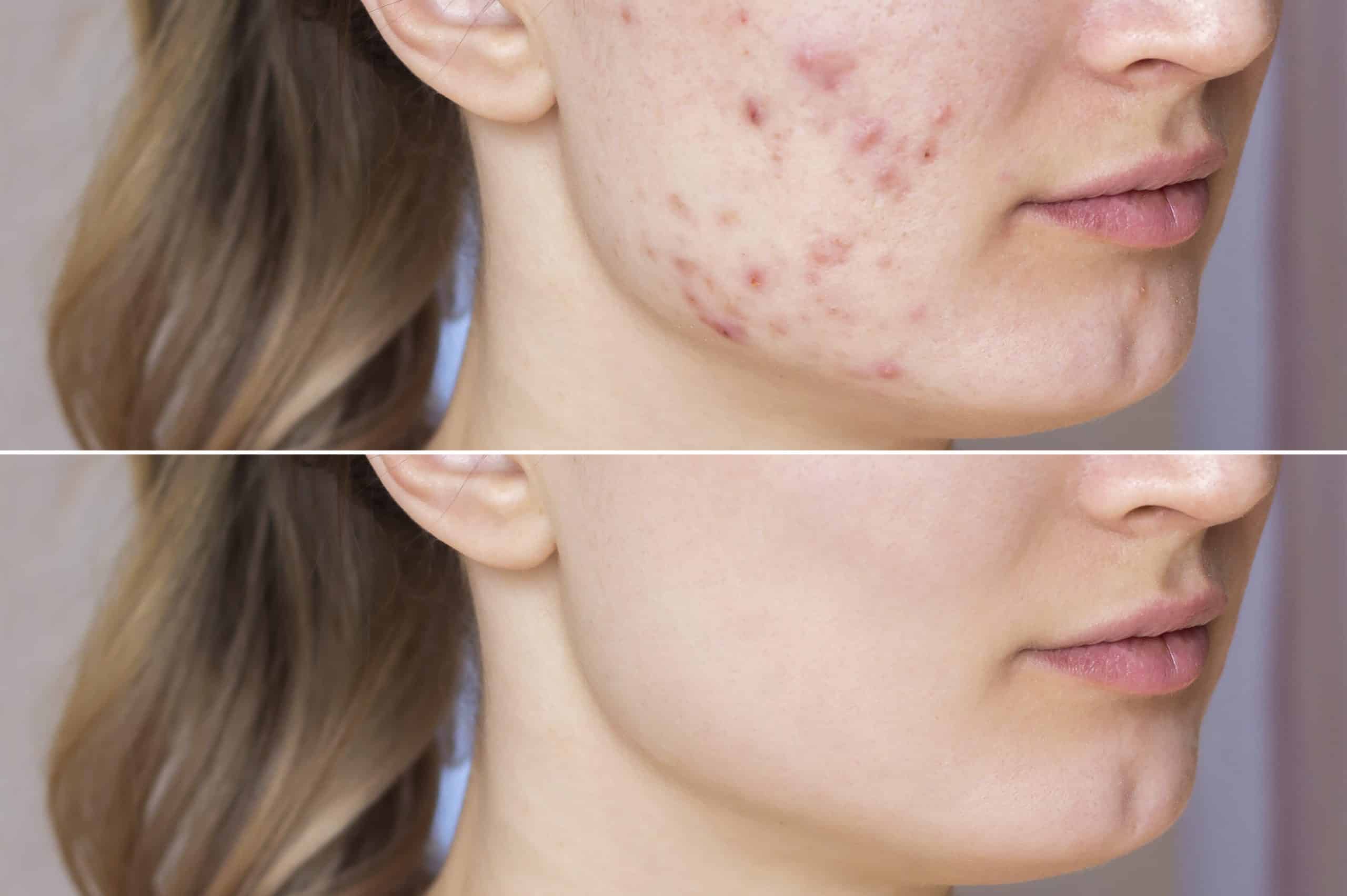 Tratamiento corporal rejuvenecedor en clínica estética en Sevilla, cuidado personalizado